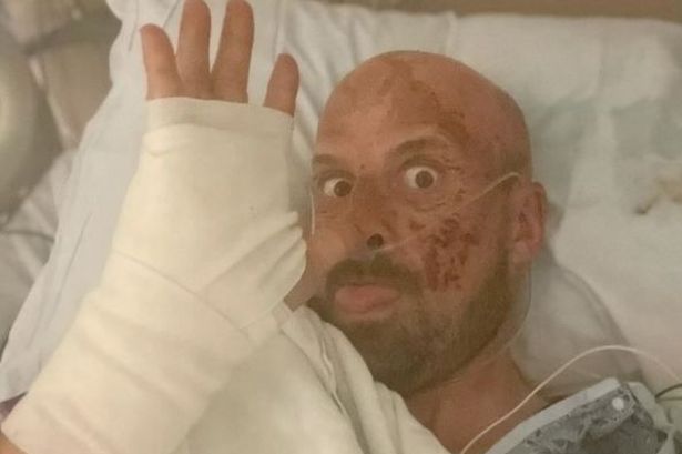 Jonathan Goodwin's Injuries