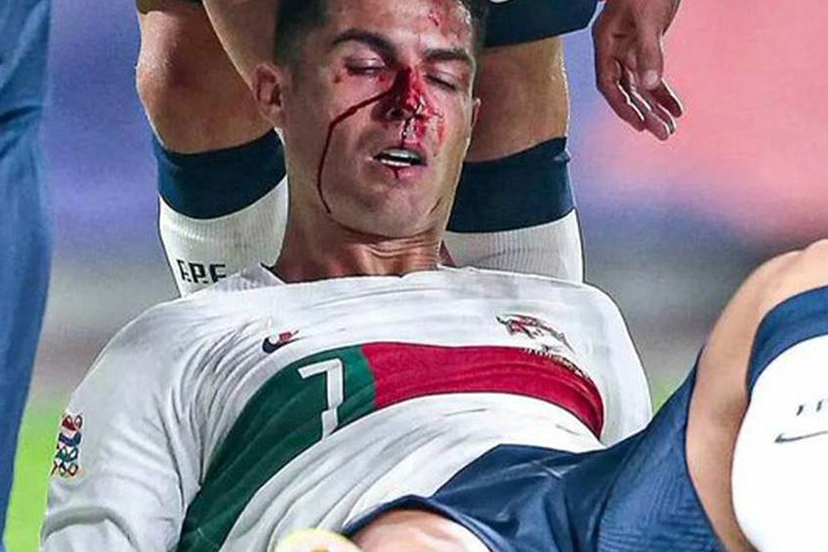 Cristiano ronaldo injury during football match